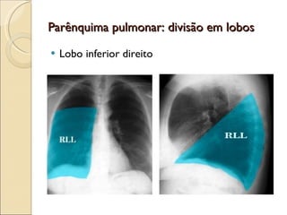 Parênquima pulmonar: divisão em lobos Lobo inferior direito 
