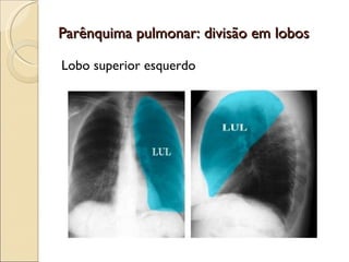Parênquima pulmonar: divisão em lobos Lobo superior esquerdo 