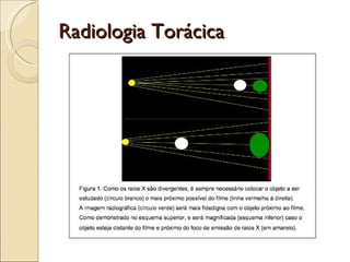 Radiologia Torácica 