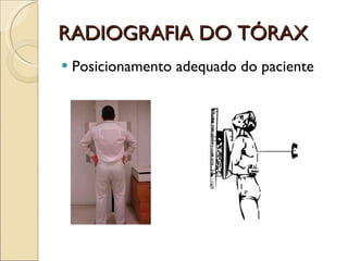 RADIOGRAFIA DO TÓRAX Posicionamento adequado do paciente 