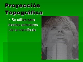Proyección Topográfica Se utiliza para  dientes anteriores de la mandíbula 