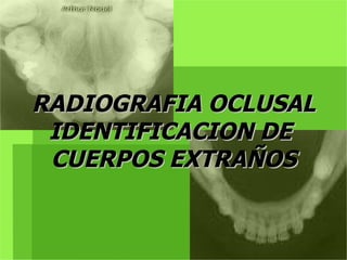 RADIOGRAFIA OCLUSAL IDENTIFICACION DE  CUERPOS EXTRAÑOS 