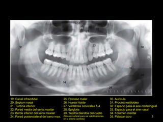 Radiografia panoramica | PPT