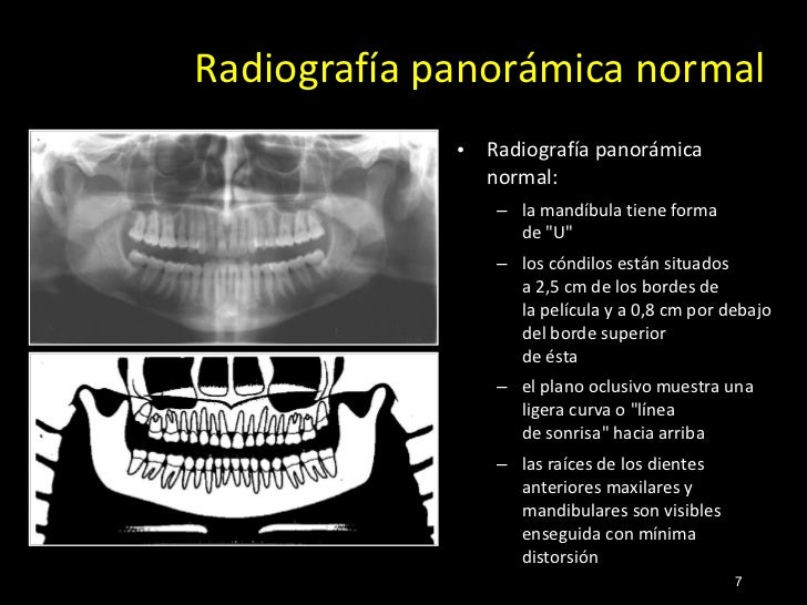 Como Echar Saliva Por Debajo De La Lengua