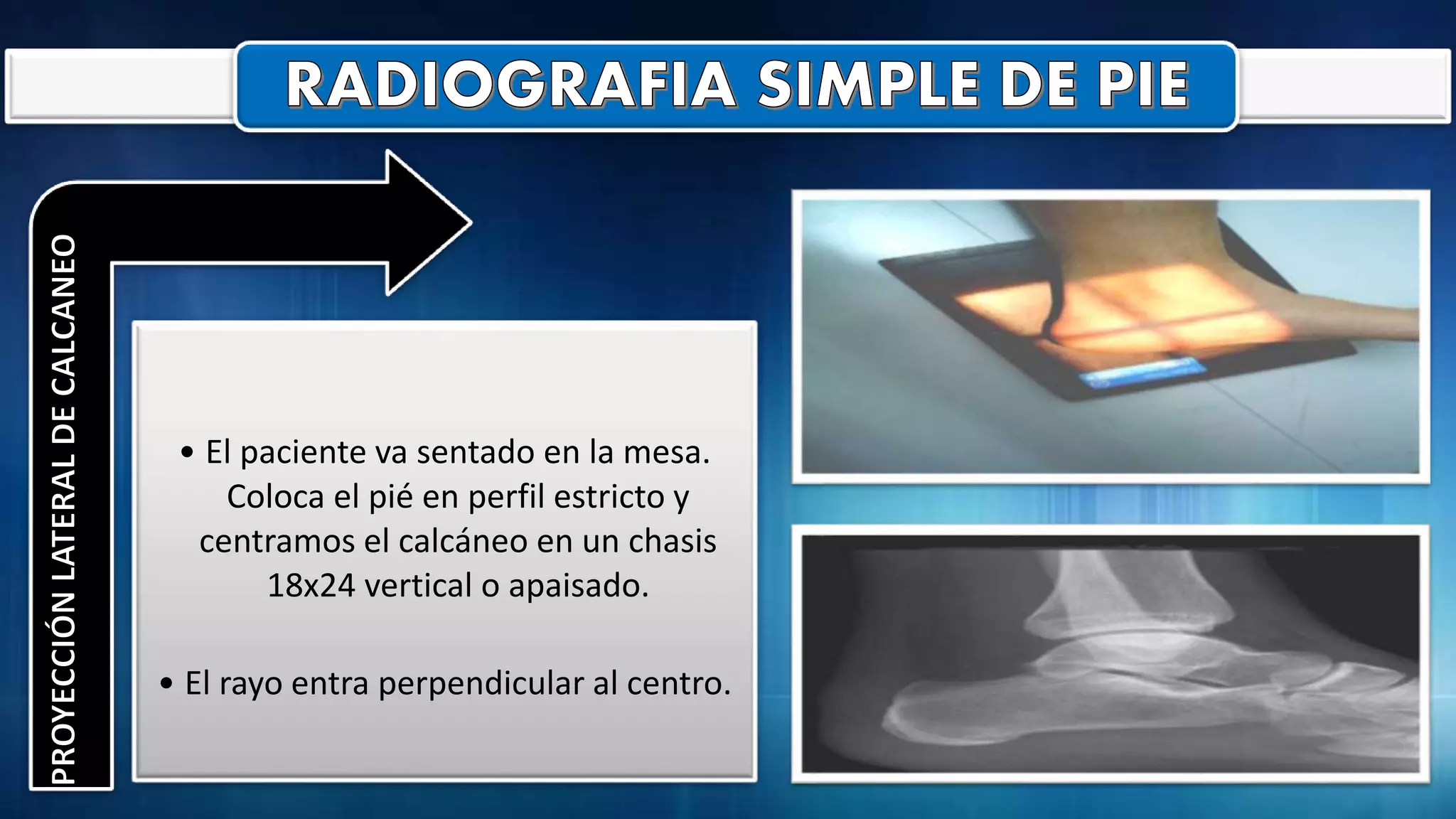 Radiografia de pie - tobillo y tibia - perone | PPTX