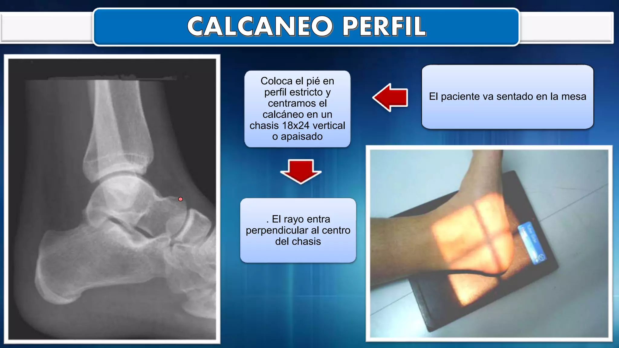 Radiografia de pie - tobillo y tibia - perone | PPTX