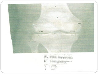Radiografias Slide 5