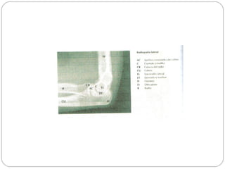 Radiografias Slide 11