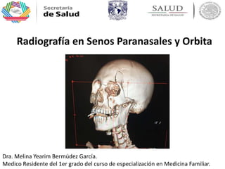 Radiografía en Senos Paranasales y Orbita
Dra. Melina Yearim Bermúdez García.
Medico Residente del 1er grado del curso de especialización en Medicina Familiar.
 