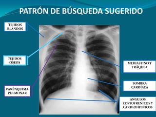 PATRÓN DE BÚSQUEDA SUGERIDO
 TEJIDOS
BLANDOS




TEJIDOS
 ÓSEOS                        MEDIASTINO Y
                               TRÁQUEA



                                 SOMBRA
                                CARDÍACA
PARÉNQUIMA
 PULMONAR
                               ANGULOS
                            COSTOFRENICOS Y
                            CARDIOFRENICOS
 