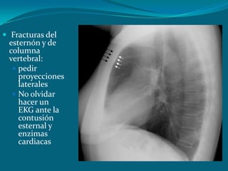  Fracturas del
 esternón y de
 columna
 vertebral:
   pedir
    proyecciones
    laterales
   No olvidar
    hacer un
    EKG ante la
    contusión
    esternal y
    enzimas
    cardiacas
 