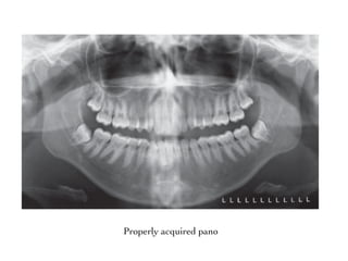 Perfect Pan Radiograph Radiograph Analysis - Orthodontics | PDF