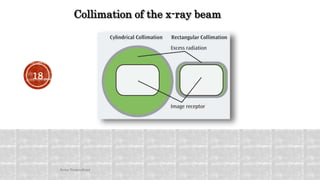 Collimation of the x-ray beam
18
Arwa Namnakani
 
