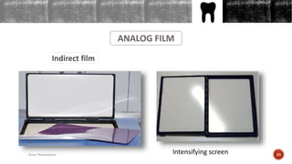 OUTLINES
ANALOG FILM
Indirect film
Intensifying screen 29Arwa Namnakani
 