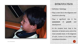  Definition- Radiology
 Plays a vital role in the diagnosis and
treatment planning .
 Plays a significant role in the
assessment of growth and
development.
 At the simplest level, help in the
detection of dental caries and at the
most complex level, in the diagnosis
of cysts, tumors or any other major
craniofacial disorders.
3Arwa Namnakani
 