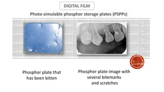 DIGITAL FILM
Photo-simulable phosphor storage plates (PSPPs)
Phosphor plate that
has been bitten
Phosphor plate image with
several bitemarks
and scratches
 