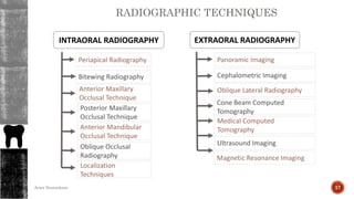 INTRAORAL RADIOGRAPHY
Periapical Radiography
Bitewing Radiography
Anterior Maxillary
Occlusal Technique
Posterior Maxillary
Occlusal Technique
Anterior Mandibular
Occlusal Technique
Oblique Occlusal
Radiography
Localization
Techniques
Panoramic Imaging
EXTRAORAL RADIOGRAPHY
Medical Computed
Tomography
Cephalometric Imaging
Oblique Lateral Radiography
Cone Beam Computed
Tomography
Ultrasound Imaging
Magnetic Resonance Imaging
RADIOGRAPHIC TECHNIQUES
37Arwa Namnakani
 