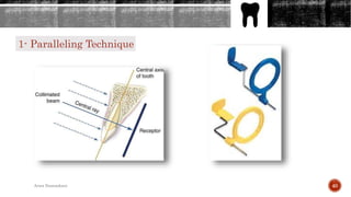 1- Paralleling Technique
40Arwa Namnakani
 
