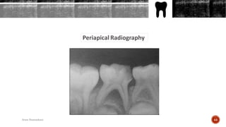 Periapical Radiography
44Arwa Namnakani
 