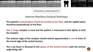 INTRAORAL RADIOGRAPHY
Anterior Maxillary Occlusal Technique
- The patient’s occlusal plane should be parallel to the floor, and the sagittal plane
should be perpendicular to the floor.
- Size 2 image receptor is used and the patient is instructed to bite lightly to hold
the receptor.
- The anterior edge of the receptor should extend approximately 2 mm in front of
the incisal edge of the central incisors.
- The x-ray beam is directed to the apices of the central incisors with the vertical
angle being +60° . 48Arwa Namnakani
 