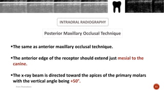 INTRAORAL RADIOGRAPHY
Posterior Maxillary Occlusal Technique
The same as anterior maxillary occlusal technique.
The anterior edge of the receptor should extend just mesial to the
canine.
The x-ray beam is directed toward the apices of the primary molars
with the vertical angle being +50°.
51Arwa Namnakani
 