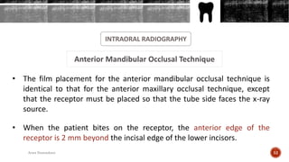 INTRAORAL RADIOGRAPHY
Anterior Mandibular Occlusal Technique
• The film placement for the anterior mandibular occlusal technique is
identical to that for the anterior maxillary occlusal technique, except
that the receptor must be placed so that the tube side faces the x-ray
source.
• When the patient bites on the receptor, the anterior edge of the
receptor is 2 mm beyond the incisal edge of the lower incisors.
52Arwa Namnakani
 