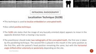 INTRAORAL RADIOGRAPHY
Localization Technique (SLOB)
 This technique is used to localize embedded or unerupted teeth.
 Also called parallax technique.
 The SLOB role states that the image of any buccally oriented object appears to move in the
opposite direction from a moving x-ray source.
 The practitioner should make two radiographs of the unerupted tooth, the first one is taken
by the paralleling technique. The second film is placed in the mouth in the same position as
the first film, with the patient’s head position remaining the same, but with the horizontal
angle shifted either anteriorly or posteriorly depending on the site.
56Arwa Namnakani
 