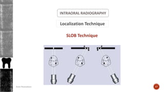 INTRAORAL RADIOGRAPHY
Localization Technique
SLOB Technique
57Arwa Namnakani
 