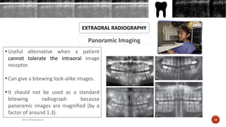 Panoramic Imaging
EXTRAORAL RADIOGRAPHY
Useful alternative when a patient
cannot tolerate the intraoral image
receptor.
Can give a bitewing look-alike images.
It should not be used as a standard
bitewing radiograph because
panoramic images are magnified (by a
factor of around 1.3).
58Arwa Namnakani
 