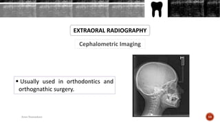 Cephalometric Imaging
EXTRAORAL RADIOGRAPHY
 Usually used in orthodontics and
orthognathic surgery.
59Arwa Namnakani
 