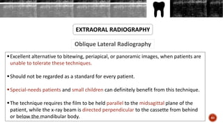 Oblique Lateral Radiography
EXTRAORAL RADIOGRAPHY
Excellent alternative to bitewing, periapical, or panoramic images, when patients are
unable to tolerate these techniques.
Should not be regarded as a standard for every patient.
Special-needs patients and small children can definitely benefit from this technique.
The technique requires the film to be held parallel to the midsagittal plane of the
patient, while the x-ray beam is directed perpendicular to the cassette from behind
or below the mandibular body. 60Arwa Namnakani
 