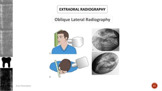Oblique Lateral Radiography
EXTRAORAL RADIOGRAPHY
61Arwa Namnakani
 