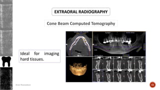 Cone Beam Computed Tomography
EXTRAORAL RADIOGRAPHY
Ideal for imaging
hard tissues.
62Arwa Namnakani
 