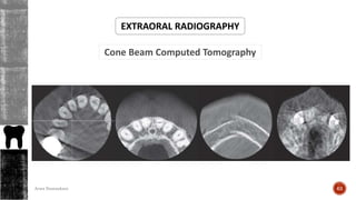 Cone Beam Computed Tomography
EXTRAORAL RADIOGRAPHY
63Arwa Namnakani
 