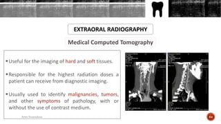 Medical Computed Tomography
EXTRAORAL RADIOGRAPHY
Useful for the imaging of hard and soft tissues.
Responsible for the highest radiation doses a
patient can receive from diagnostic imaging.
Usually used to identify malignancies, tumors,
and other symptoms of pathology, with or
without the use of contrast medium.
64Arwa Namnakani
 