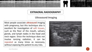 Ultrasound Imaging
EXTRAORAL RADIOGRAPHY
Most people associate ultrasound imaging
with pregnancy, but this technique also is
excellent for investigation of soft tissues,
such as the floor of the mouth, salivary
glands, and lymph nodes in the head and
neck region. Since the technique does not
involve ionizing radiation, it can be
repeated as many times as necessary,
without exposing the patient to any risks.
65Arwa Namnakani
 