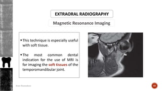 Magnetic Resonance Imaging
EXTRAORAL RADIOGRAPHY
This technique is especially useful
with soft tissue.
The most common dental
indication for the use of MRI is
for imaging the soft tissues of the
temporomandibular joint.
66Arwa Namnakani
 