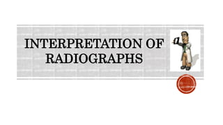 INTERPRETATION OF
RADIOGRAPHS
 