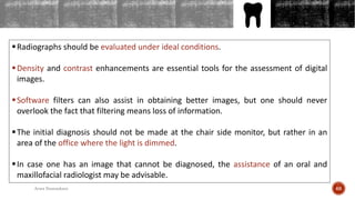 OUTLINES
Radiographs should be evaluated under ideal conditions.
Density and contrast enhancements are essential tools for the assessment of digital
images.
Software filters can also assist in obtaining better images, but one should never
overlook the fact that filtering means loss of information.
The initial diagnosis should not be made at the chair side monitor, but rather in an
area of the office where the light is dimmed.
In case one has an image that cannot be diagnosed, the assistance of an oral and
maxillofacial radiologist may be advisable.
68Arwa Namnakani
 