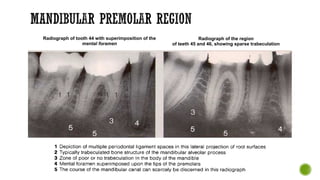 Sparse Teeth Radiographic-Anatomy-Periapical-Occlusal-Radiograph (1).pdf