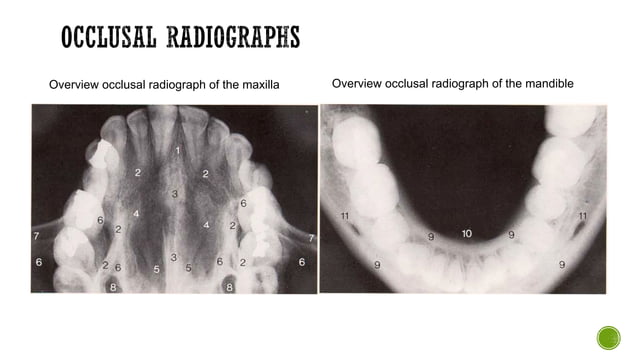 Radiographic-Anatomy-Periapical-Occlusal-Radiograph (1).pdf
