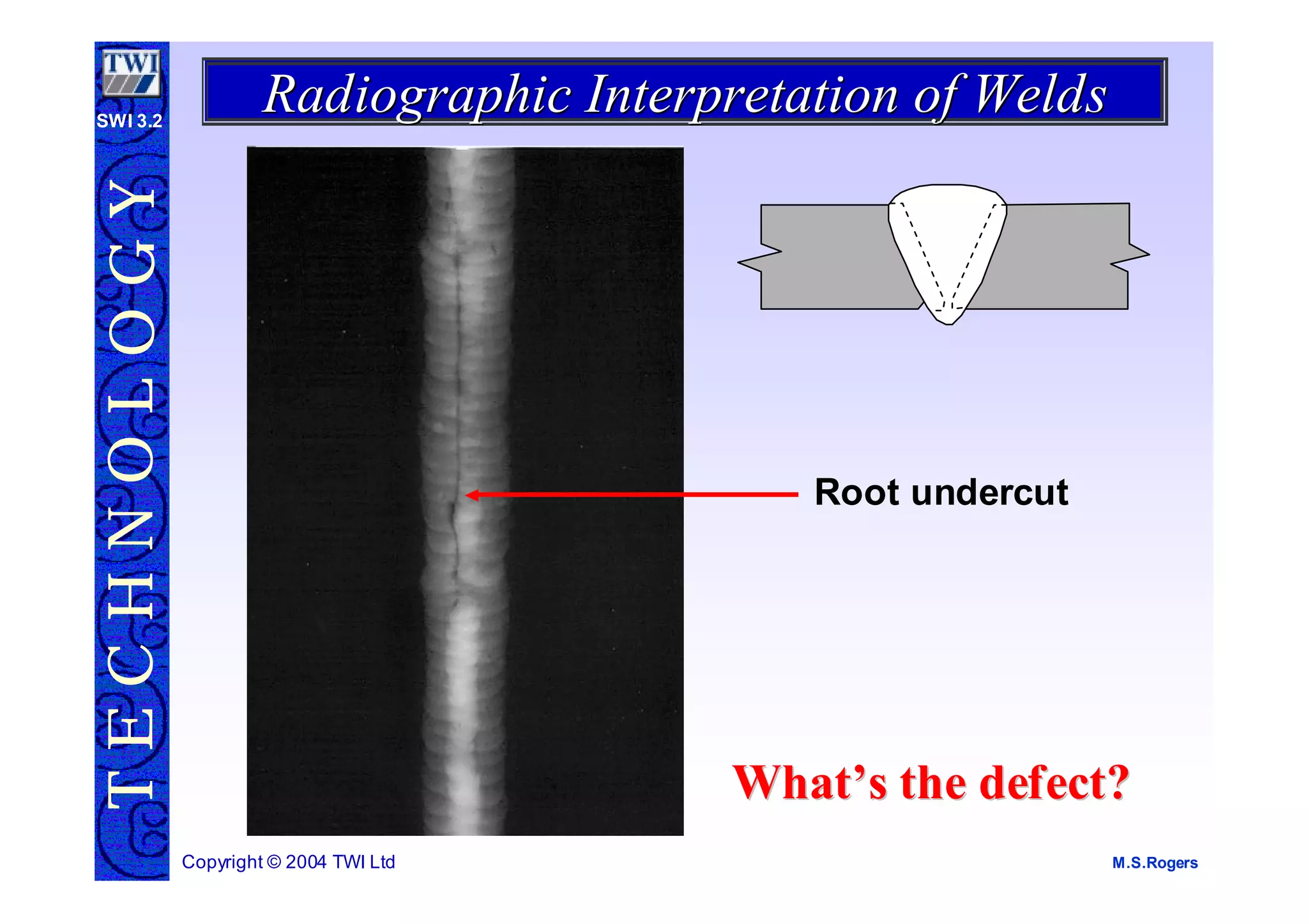 Undercut Radiograph radiographic-interpretation.pdf