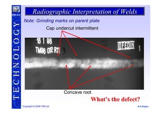 Undercut Radiograph radiographic-interpretation.pdf