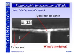 Undercut Radiograph radiographic-interpretation.pdf