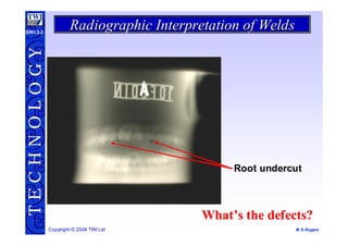 Undercut Radiograph radiographic-interpretation.pdf