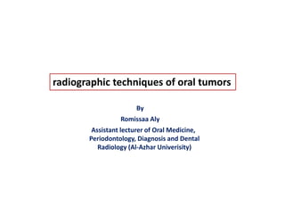 radiographic techniques of oral tumors
By
Romissaa Aly
Assistant lecturer of Oral Medicine,
Periodontology, Diagnosis and Dental
Radiology (Al-Azhar Univerisity)
 