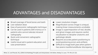 Radiographic aids used in Periodontal Diagnosis | PPTX