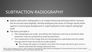 Substraction Radiograph Unit Radiographic aids used in Periodontal Diagnosis | PPTX