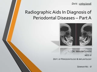 -
Radiographic Aids In Diagnosis of
Periodontal Diseases – Part A
 