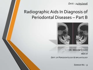 -
Radiographic Aids In Diagnosis of
Periodontal Diseases – Part B
 